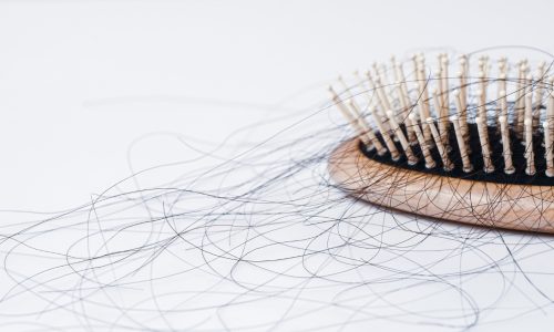 Zet de schaamte rond haarverlies een rem op je sociale contacten? Eenzaamheid is slecht voor je mentale én fysieke gezondheid.