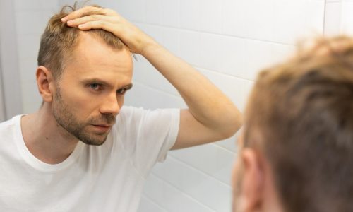 Een haarwerk geeft mensen met diverse haarproblemen een kapsel dat altijd in topvorm is. Daarom bestaan er verschillende types haarwerken.