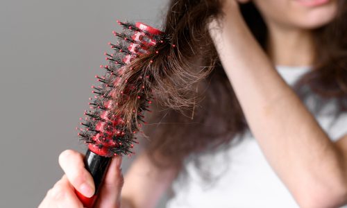 Heb je last van haaruitval door stress? Let dan op voor de vicieuze cirkel van nog meer stress en haaruitval. Laat het niet zover komen.